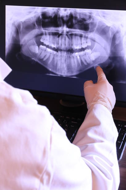 Best Emergency Tooth Extraction in Charlotte, MI