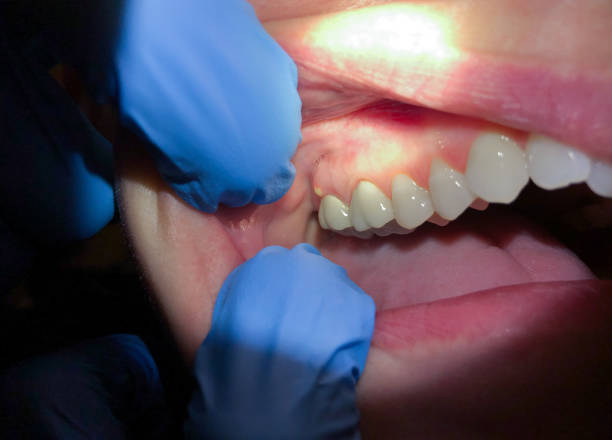 Best Emergency Dental Surgery in Charlotte, MI