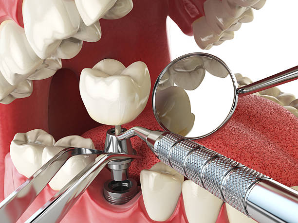Best Emergency Dental Care for Trauma or Injury in Charlotte, MI